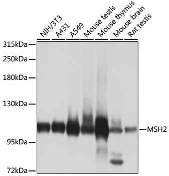 MSH2 Polyclonal Antibody (E-AB-60195)
