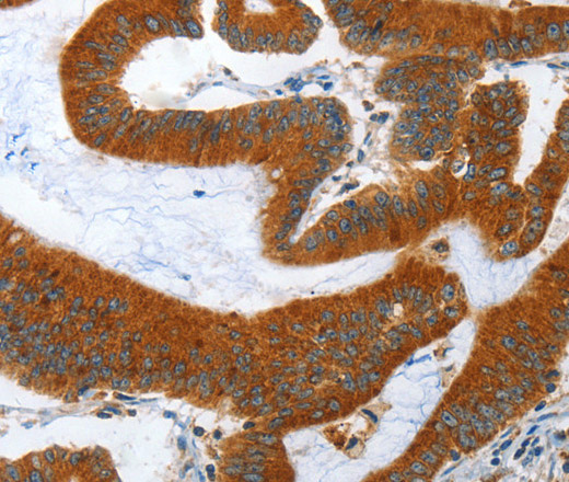 ANAPC10 Polyclonal Antibody (E-AB-10809)