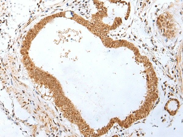 PEG3 Polyclonal Antibody (E-AB-19429)