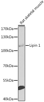Lipin 1 Polyclonal Antibody (E-AB-92878)