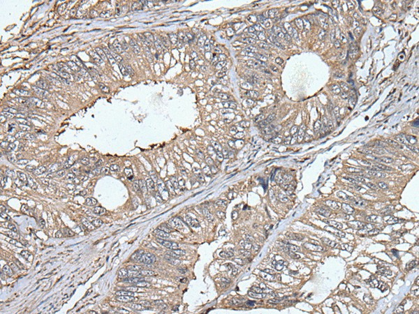 UNC13B Polyclonal Antibody (E-AB-18509)