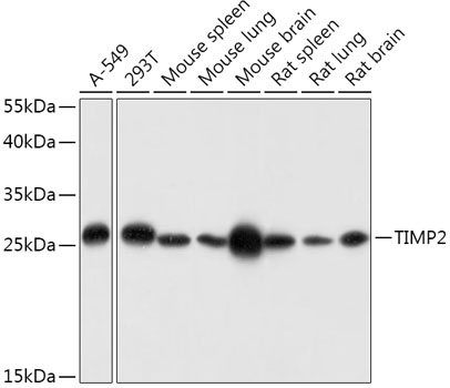TIMP2 Polyclonal Antibody (E-AB-60338)