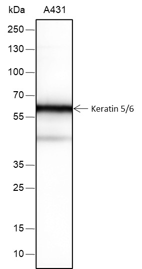 Recombinant Keratin 5/6 Monoclonal Antibody (AN301581L)