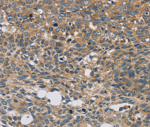 STAT4 Polyclonal Antibody (E-AB-13826)