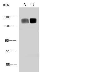 CD13 /ANPEP Monoclonal Antibody (AN200163P)