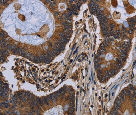 FGF18 Polyclonal Antibody (E-AB-15030)