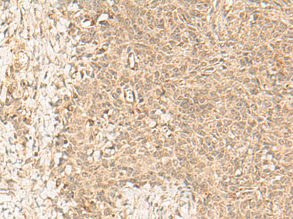 FBXL4 Polyclonal Antibody (E-AB-19857)