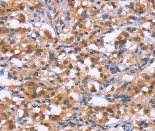 BRK1 Polyclonal Antibody (E-AB-16477)