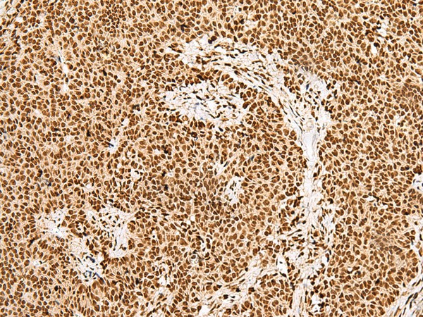 GRSF1 Polyclonal Antibody (E-AB-18061)