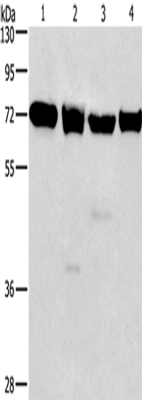IL2RB Polyclonal Antibody (E-AB-11040)