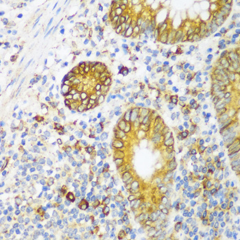ERLIN1 Polyclonal Antibody (E-AB-65128)
