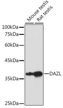 DAZL Polyclonal Antibody (E-AB-68311)