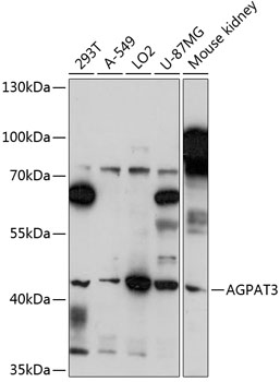 AGPAT3 Polyclonal Antibody (E-AB-90835)