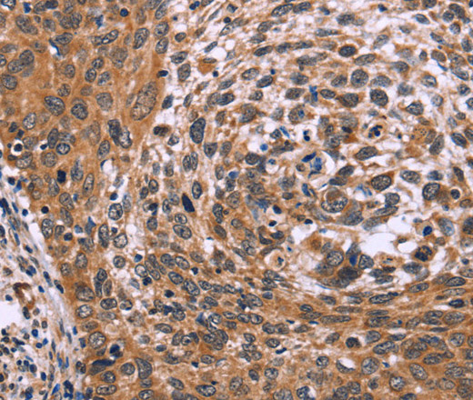 ING2 Polyclonal Antibody (E-AB-10397)