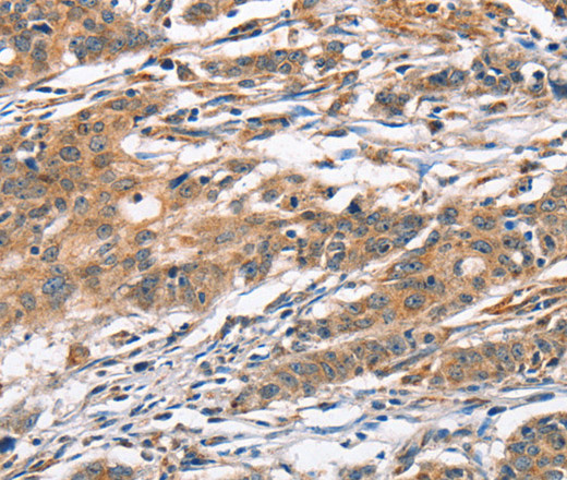 CAMK4 Polyclonal Antibody (E-AB-11025)