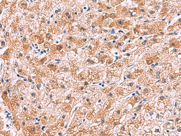 IL4R Polyclonal Antibody (E-AB-52020)