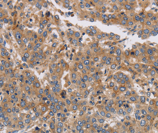 KCNG1 Polyclonal Antibody (E-AB-16535)