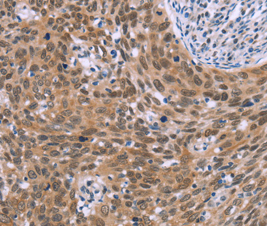 GLYR1 Polyclonal Antibody (E-AB-13272)
