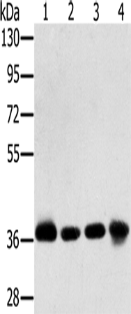 CLP36 Polyclonal Antibody (E-AB-15288)