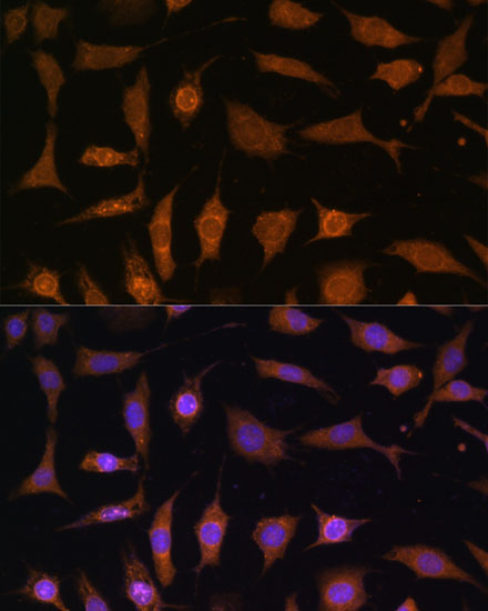 PDE6D Polyclonal Antibody (E-AB-65101)