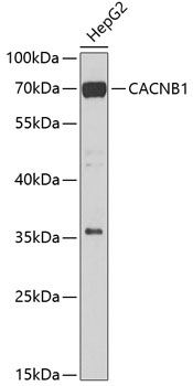 CACNB1 Polyclonal Antibody (E-AB-62020)