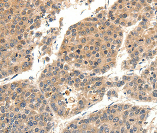SLC27A1 Polyclonal Antibody (E-AB-12872)