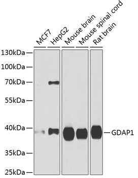 GDAP1 Polyclonal Antibody (E-AB-61240)