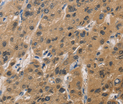 DUSP26 Polyclonal Antibody (E-AB-11170)