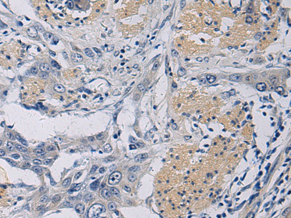 KLF1 Polyclonal Antibody (E-AB-19799)