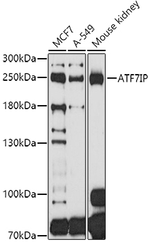 ATF7IP Polyclonal Antibody (E-AB-90168)