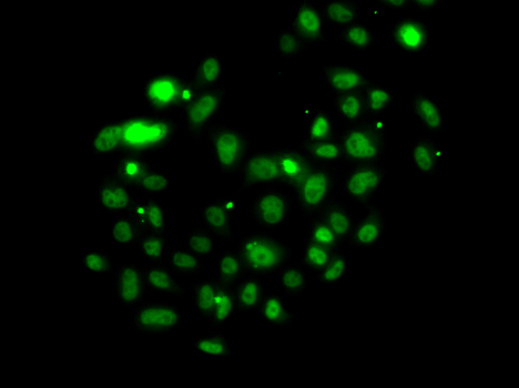 (KO Validated) PMS2 Polyclonal Antibody (E-AB-64786)