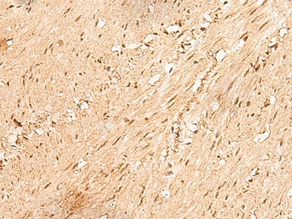 JPT2 Polyclonal Antibody (E-AB-52705)