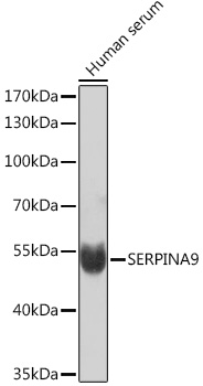 SERPINA9 Polyclonal Antibody (E-AB-91463)