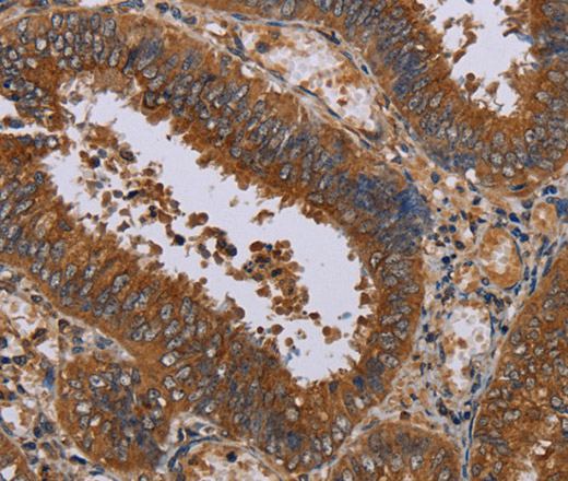 NPTX1 Polyclonal Antibody (E-AB-16659)