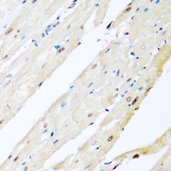 VCP Polyclonal Antibody (E-AB-64589)