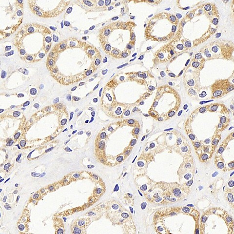 PMVK Polyclonal Antibody (E-AB-70220)