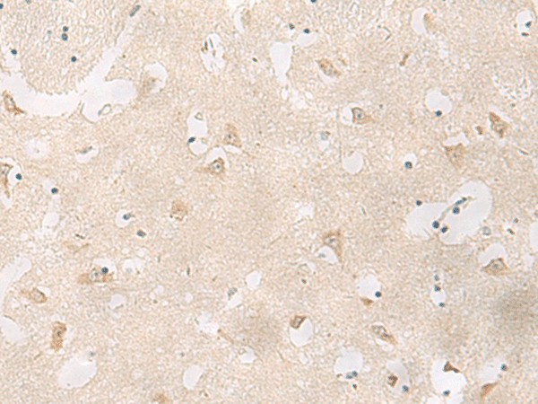 GPR83 Polyclonal Antibody (E-AB-19959)