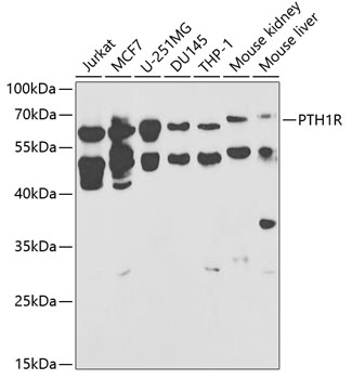 PTH1R Polyclonal Antibody (E-AB-93210)