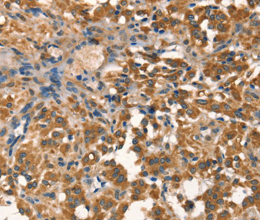 AGO1 Polyclonal Antibody (E-AB-13207)