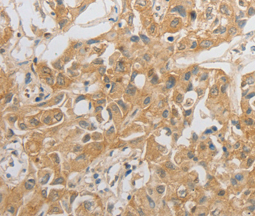 HCRTR2 Polyclonal Antibody (E-AB-15812)