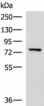 CAPN5 Polyclonal Antibody (E-AB-52138)