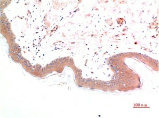 Phospho-SMAD3 (Ser425) Monoclonal Antibody (E-AB-51043)