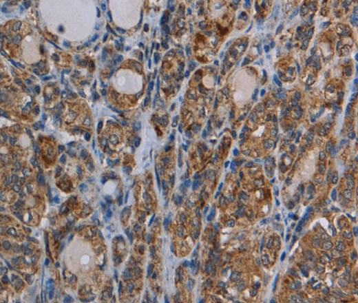 MYO7A Polyclonal Antibody (E-AB-13433)