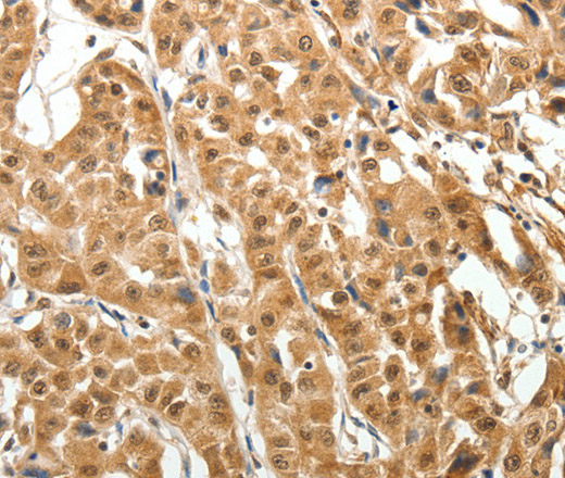 MAP1A Polyclonal Antibody (E-AB-12895)