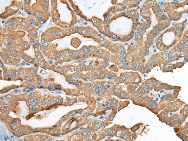 USP12 Polyclonal Antibody (E-AB-52445)