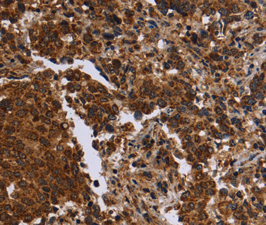 FMN2 Polyclonal Antibody (E-AB-13249)