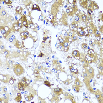 IL4 Polyclonal Antibody (E-AB-62102)