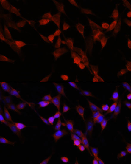 UBIAD1 Polyclonal Antibody (E-AB-66249)