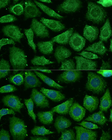 NDUFB3 Polyclonal Antibody (E-AB-64992)