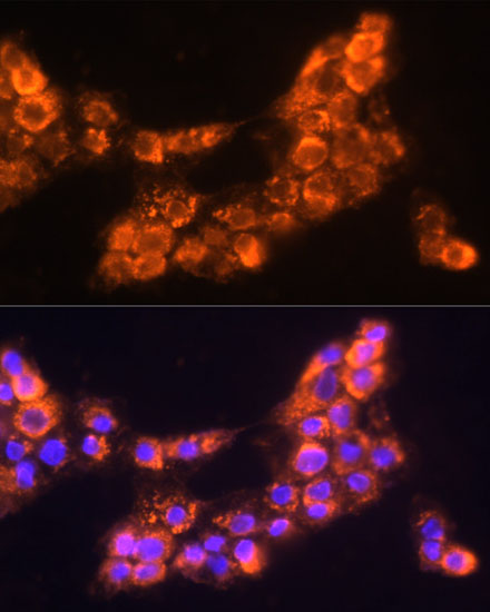 LAMC2 Polyclonal Antibody (E-AB-67376)